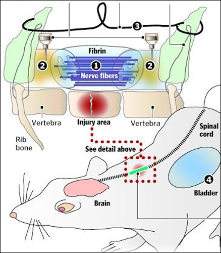  С помощью двух десятков нервных волокон ученые соединили разорванный спинной мозг. На рисунке видны нервные волокна и тонкий металлический проводок, защищающий новое нервное соединение от обрыва.